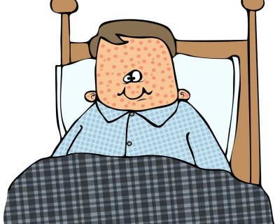 A primer: measles, mumps and rubella Measles can spread rapidly, according to health officials.